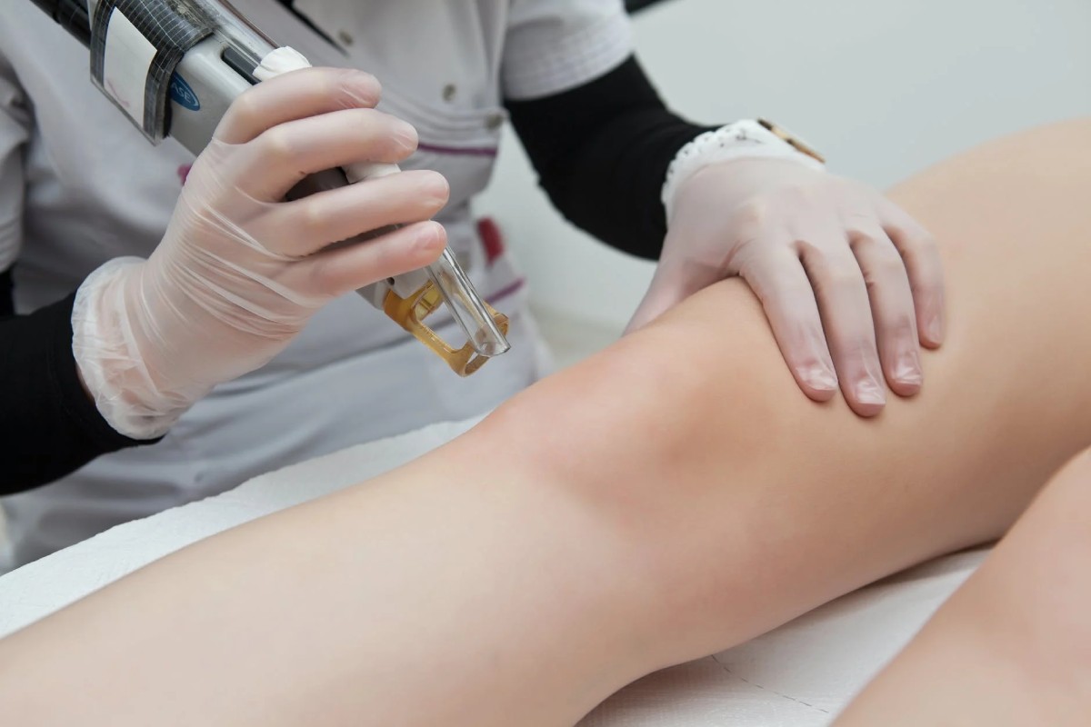 What Should You Know About the Laser Hair Removal Process?