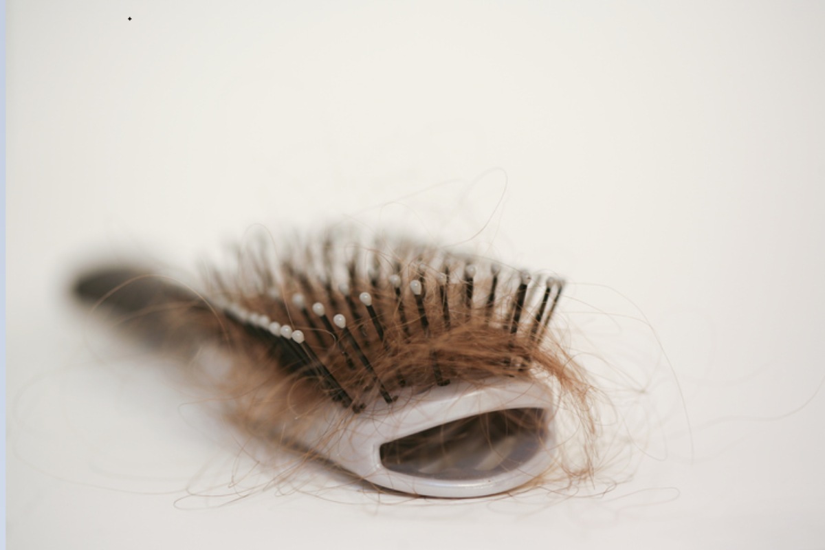 Is Non-surgical Hair Restoration Everlasting?