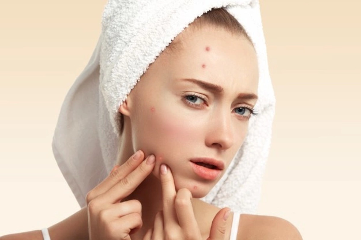 5 Natural Ways To Treat Hard Pimple? 